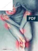 Diagnostico y Tratamiento de Artrosis