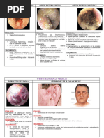 Miringitis Bullosa: Etiología y Tratamiento | PDF