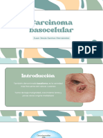 Carcinoma Basocelular