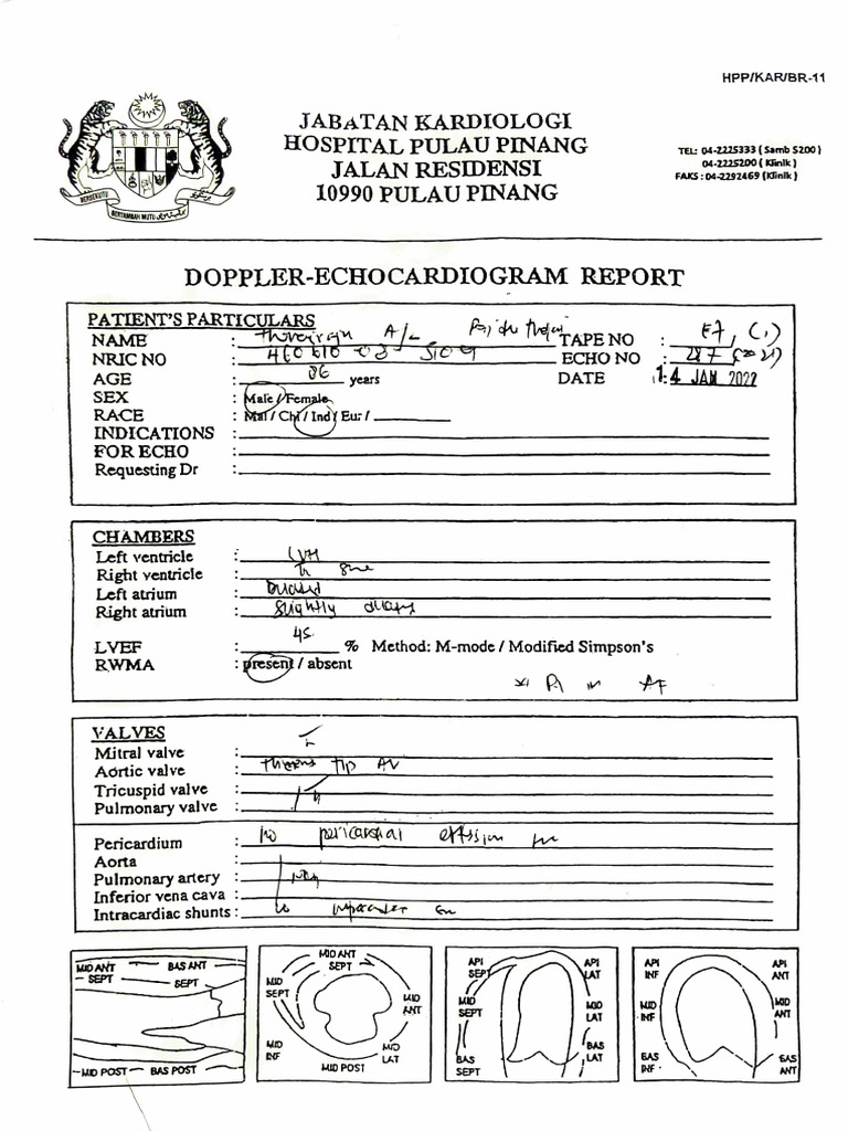 Echocardio Pdf Heart Valve Ventricle Heart