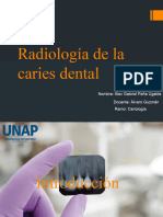 Radiología de La Caries Dental Modificado Casi Final