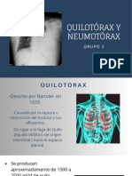 Tema 2 - Quilotorax Y Neumotorax