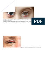 Diseases of The Eye