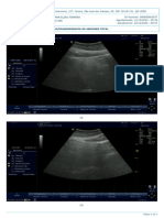 1ee98ee3 A94c 61de 84de Eefc397eb624 Ultrasom Abdomen Total