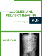 Abdomen & Pelvis CT Imaging