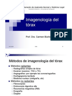 Imagenologia torax 2006