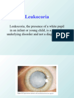 Leukocoria of Dermatology Sana'a University