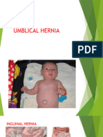 UMBLICAL HERNIA