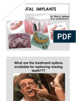 Dental Implants