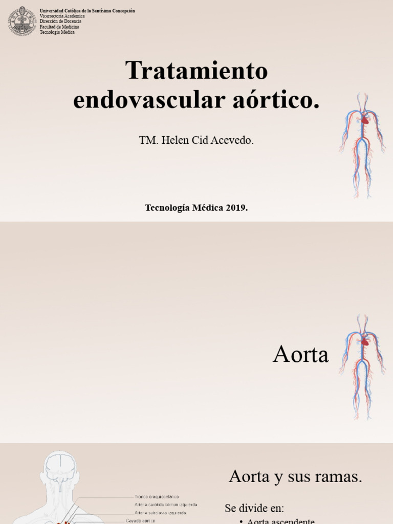 Tratamiento Endovascular de Aneurismas Aórticos | PDF | Aorta ...