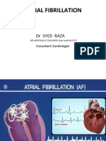 Atrial Fibrillation