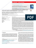 Labial Repositioning Using Polymethylmethracylate (PMMA) - Based Cement For Esthetic Smile Rehabilitation-A Case Report