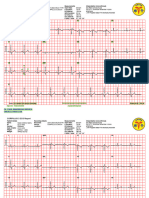 Ecg 23.01.2024