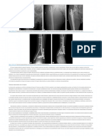 879 ChapmansChapmans Comprehensive Orthopaedic Surgery 4 Volume Set 2019