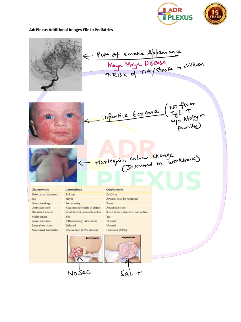 Decorticate vs Decerebrate Posturing Explained | PDF | Spinal Cord ...