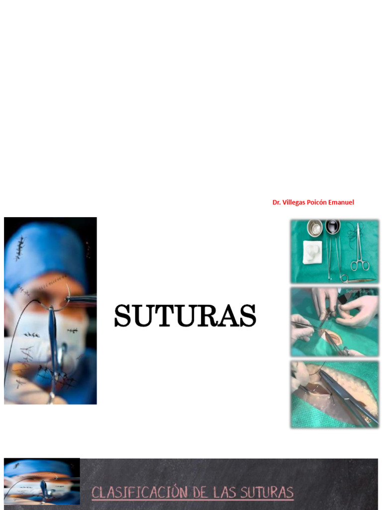 Suturas De Enfermería Pdf