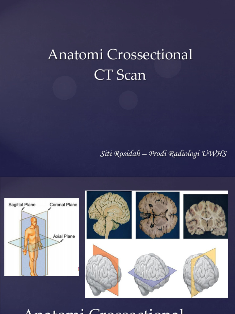 Anatomi Crossectional Ct Scan Non Kontras Pdf