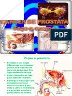 Cancer de Prostata