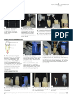 EW StepByStep PostCore EN