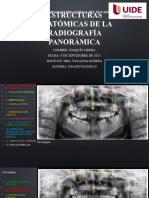 Estructuras Anatómicas de La Radiografía Panorámica
