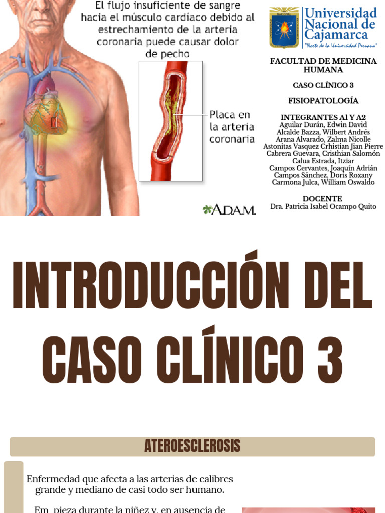 Caso Clínico de Aterosclerosis | PDF | Infarto de miocardio ...