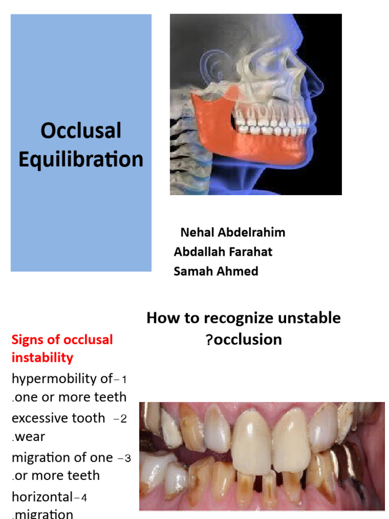 Occlusal Equilibration PDF Mouth Dental Anatomy