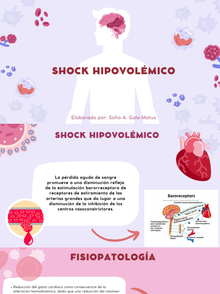 Shock Hipovolemico | PDF | Medicina CLINICA | Especialidades Medicas