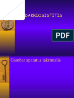 DAKRIOSISTITIS