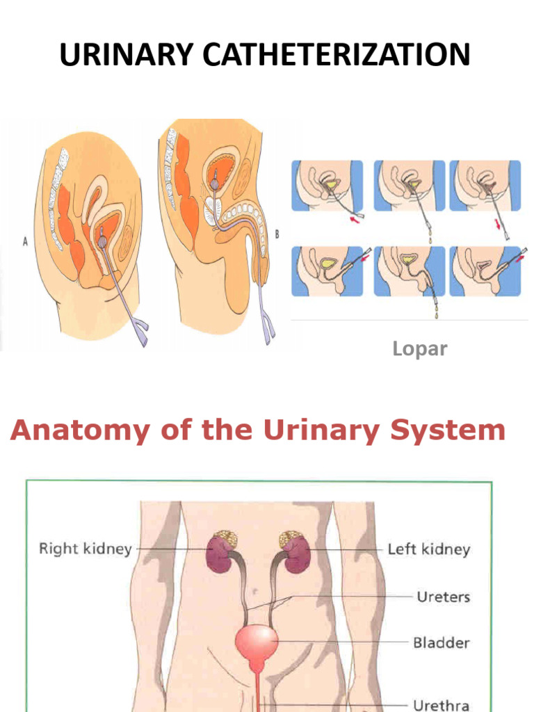 Urinary Catheterization Guide | PDF | Urinary Incontinence | Catheter