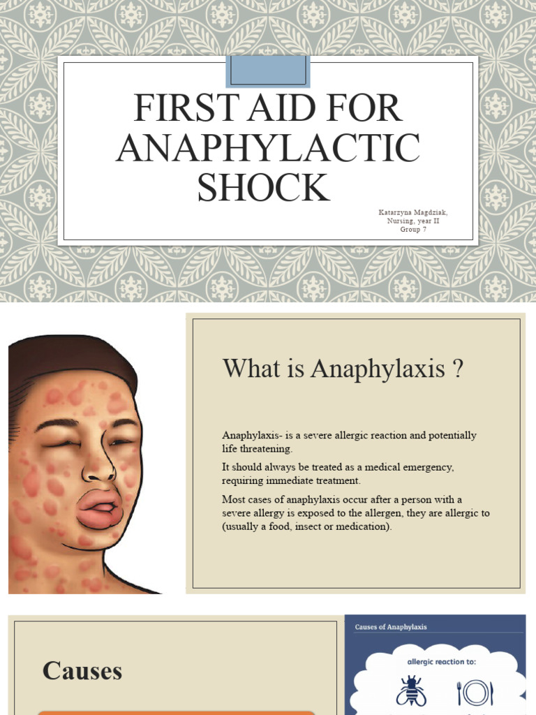 Angielski Anaphylactic Shock First Aid PDF Allergy Shock