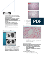 Insuficiencia Respiratoria pt2