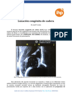 Luxación Congénita de Cadera