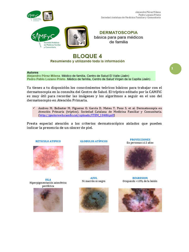 Dermatoscopia Básica para Médicos de Familia | PDF | Melanoma ...