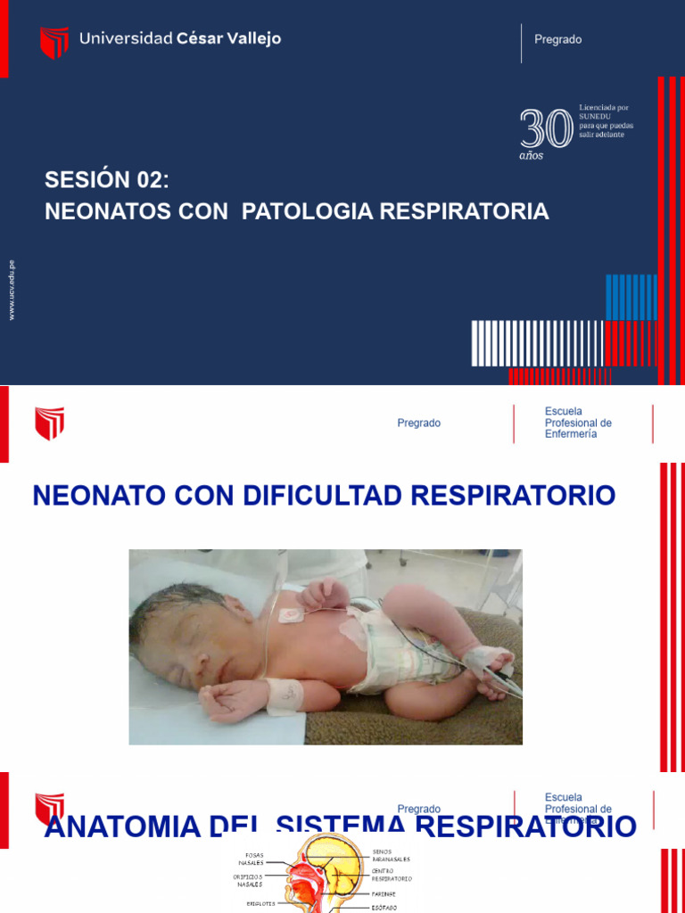 Dificultad Respiratoria en Neonatos | PDF | Sistema respiratorio ...