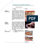 Tipos de Prótesis y Su Clasificación