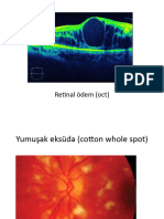 Faqatgina gozal tranniylarning katta yaralari bolgan fotosuratlari
