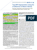 Automatic 4D Flow MRI Segmentation Using the Standardized Difference of Means Velocity