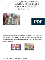 Principios para La Colocacion Del Implante Dental