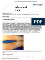 Hyperthyroidism and Thyrotoxicosis - Practice Essentials, Background, Pathophysiology