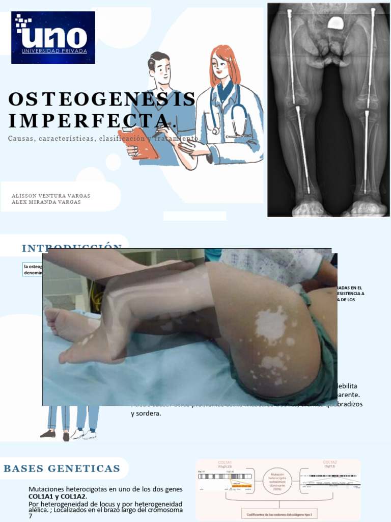 osteogenesis-imperfecta-pdf-hueso-enfermedades-y-trastornos-humanos