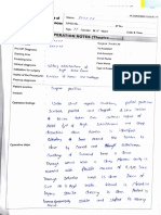 Osteochondrma of Right Distal Femur