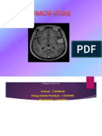 Tumor Otak Kelompok 8