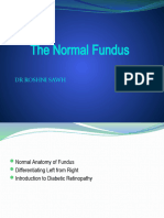 Introduction To Fundus