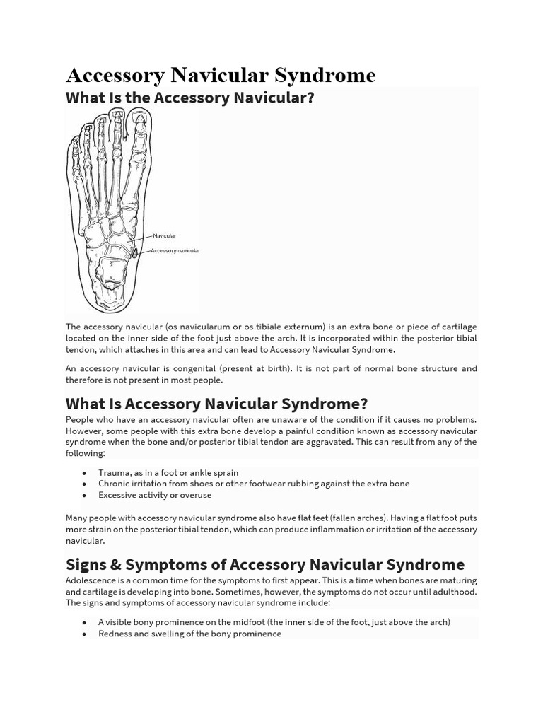 Accessory Navicular Syndrome | PDF | Clinical Medicine ...