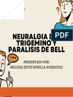 Neuralgia Del Trigemino y Paralisis de Bell. Melissa Bonilla R