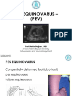 Pes Equinovarus - (PEV) : Prof - Metin Doğan, MD