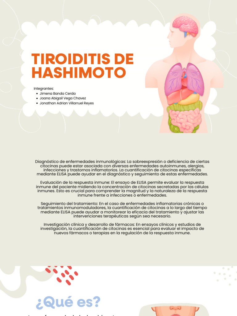 Tiroiditis de Hashimoto Seminario 1 Presetación Inmunología Clinica ...