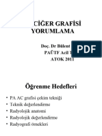 Akciğer Grafisi Yorumlama