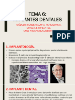 Tema 6. Implantes v2