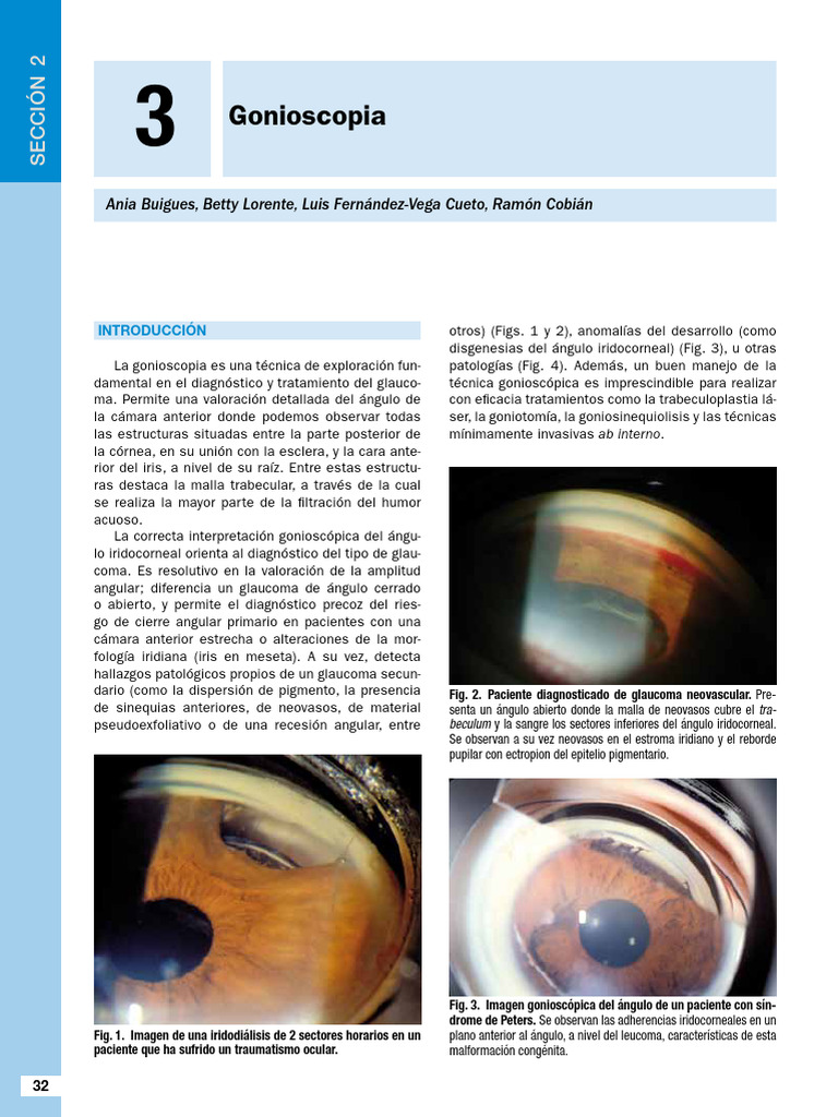Gonios | PDF | Glaucoma | Córnea, image size:768x1024